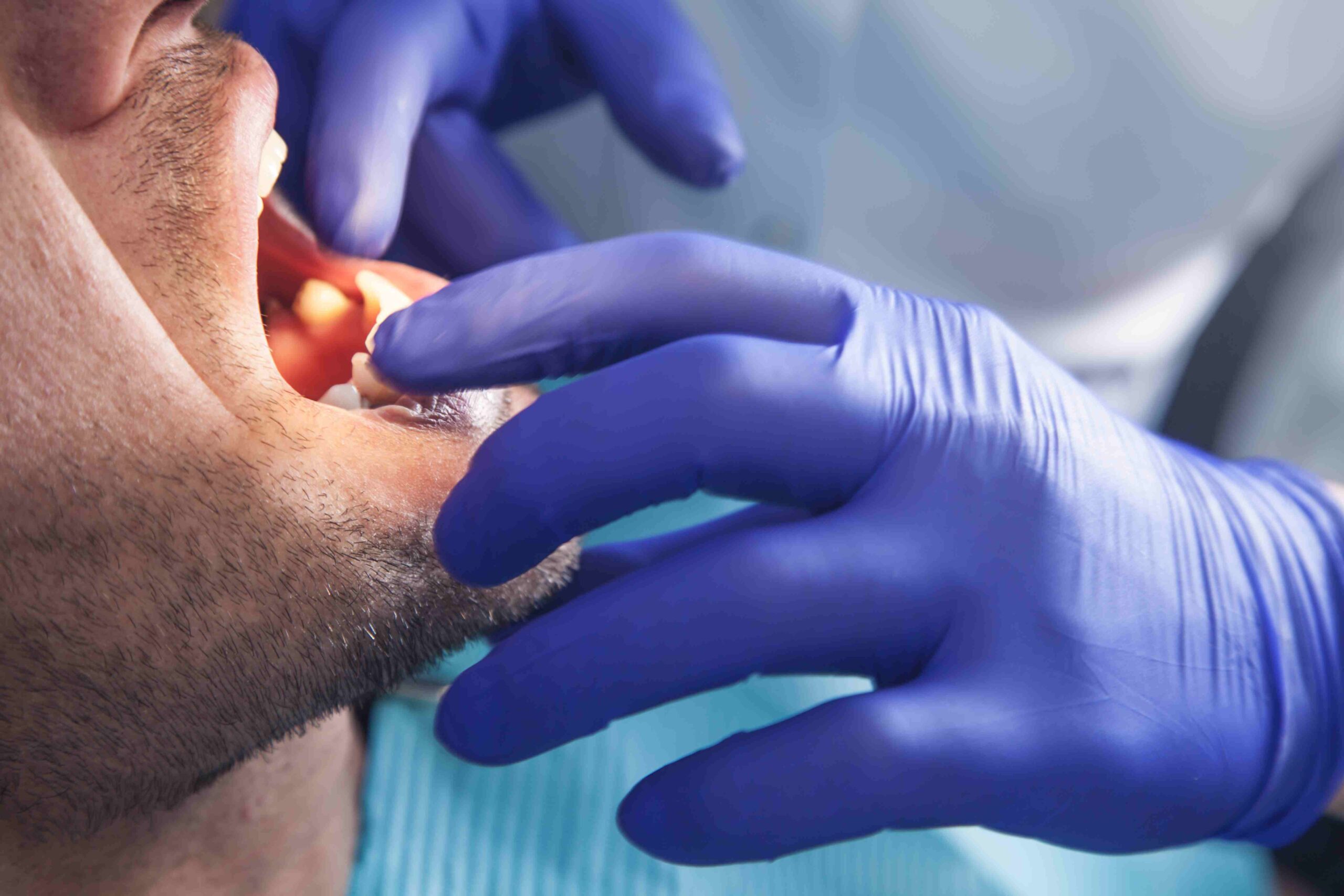 Comprehensive Oral Exams in Surrey