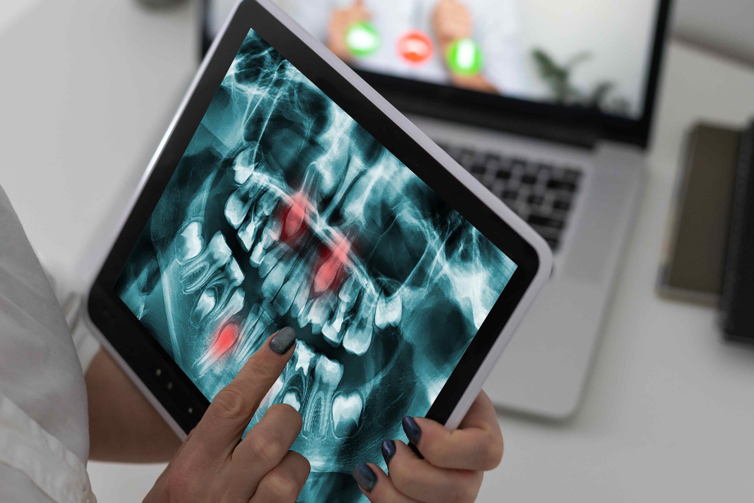 Digital X-Rays