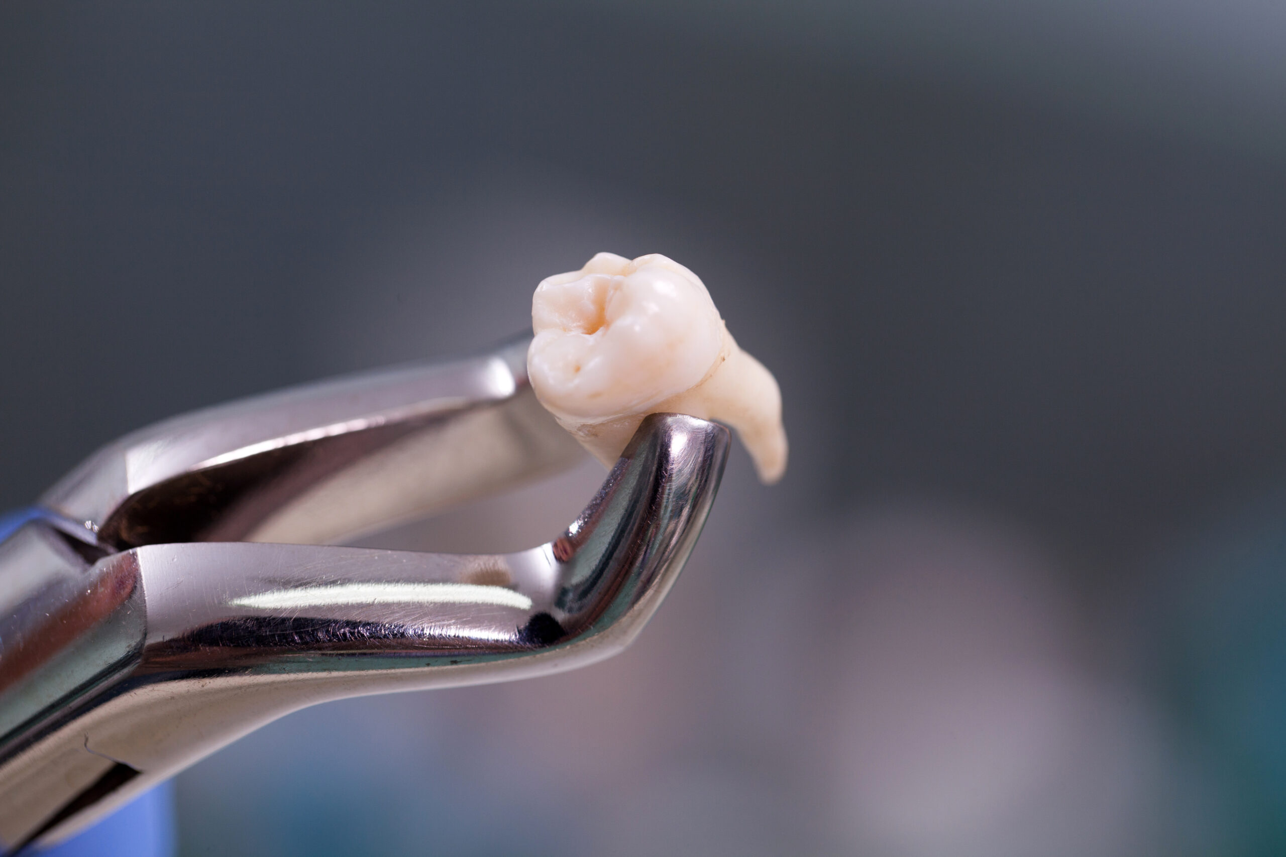 Dental equipment,tooth extraction